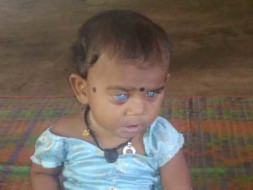 Support Vidhi Recover From Eye Cataract