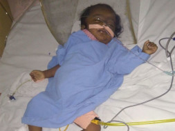 1 Year Old Lasya Priya Needs Your Help Fight Liver Problem