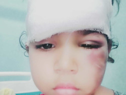 Help Vishnupriya recover from accident