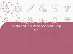 I’m Struggling With Face Injury Sustained In A Road Accident, Help Me.