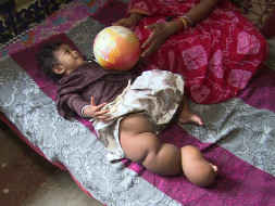 Help Pragya Fight Rare Disease