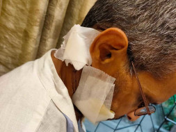 Support Mukesh Fight From Carcinoma Cancer