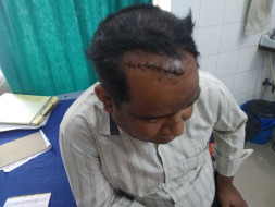 Help Pradeep Gangwa Recover From Accident