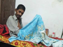 This 49 Years Old Needs Your Urgent Support In Fighting Pulmonary Tuberculosis