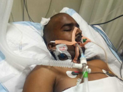 22 years old Umesh needs your help fight Head injury and neurological shock
