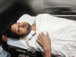 Support Md Sazad Alam Recover From Head Injury