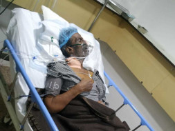 Support Sagayaraj Undergo Liver Transplant