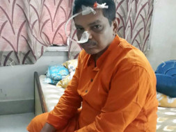 Help Me Fight Brain Stroke
