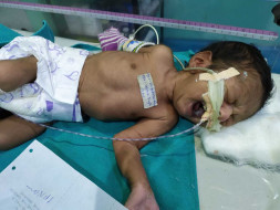 Help My Nephew Recover From Brain Tumor