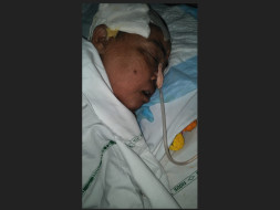 My Mother Is Struggling With Brain Stroke, Help Her