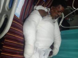 Support Manjunatha Recover From Gas Cylinder Blast Accident