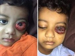 Please Help Goutham Kaloji Recover From Leukemia
