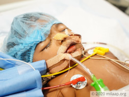 6 Months Old Rashmika Needs Your Help To Fight Gastrointestinal Infection