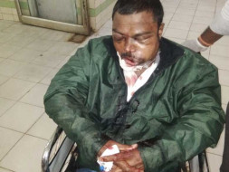 My Brother Needs Your Urgent Support In Fighting Accident (Brain And Face Injury)