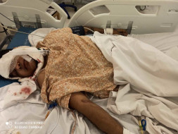 Help my friend Ritesh Singh Dhanik fight Road traffic accident with polytrauma