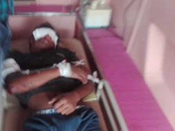 Help My Relative Fight Road Traffic Accident With Polytrauma