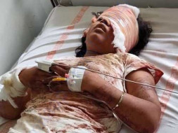 Lakshmi Needs Your Urgent Help To Fight Multiple Accident Fractures