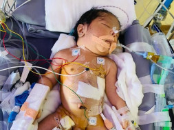1 Day Old Baby Of Ashwini Needs Your Help Fight Congenital Diaphragmatic Hernia