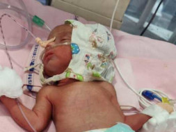 Help my new born baby to fight for life