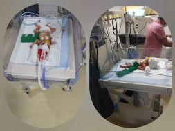 *Support My Preterm Born Twin Babies For Their NICU Treatment*