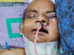 Support Sanamul Haque Recover From Mouth Cancer