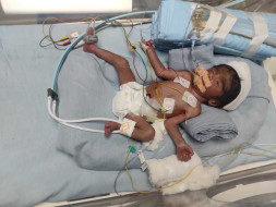 Help 12 Days Old Baby Swathi Undergo NICU Care
