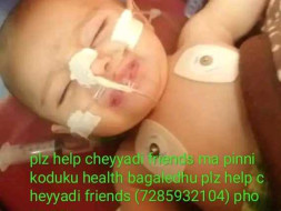 Help Baby Of Anita Undergo Surgery