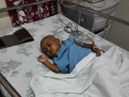 2 years old Dimpanna R needs your help fight blood cancer (Acute lymphoblastic leukemia)