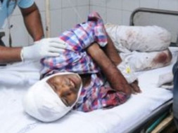 Help My Brother Fight Accident Head Injury