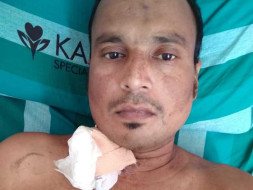 Please Help to Transfer kidney
