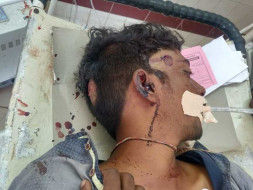 Support Arjun To Recover From Accidental Injuries