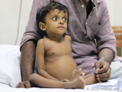 Help my 3 years daughter to recover from liver problem