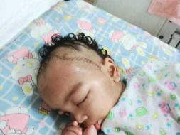 Help Deepa Sathish's 2-year-old Son Midhun Fight Brain Tumor (ATRT)
