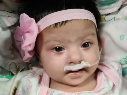 Support Sadaf Aftab Ghanewala Recover From Av Canal Defect