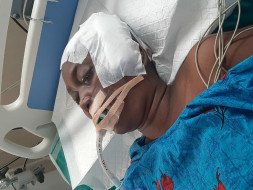 My Cousin Is Struggling With Brain Tumour, Help Her