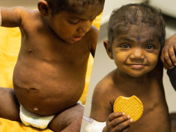 Support Kesiya Anns for her Liver Transplant