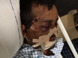 Support Ramesh Recover From Accidental Injuries