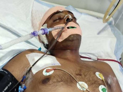 My 25 year old cousin is struggling with Head injury and neurological shock, help him