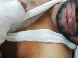 HELP Ajay To Recover From Depression And Live A Better Life