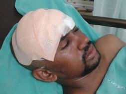 Help My Friend Kona Bhushan Teja For His Medical Treatment