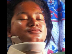 Help My Sister Fight Head Injury And Neurological Shock