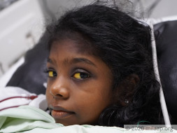 Help my recover from Wilson disease