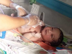 Support Baby Of Sravanthi Undergo Heart Surgery