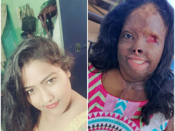 Help Zakira Recover From Acid-Attack