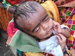 Help! Two-month-old baby Saloni to survive a serious medical condition