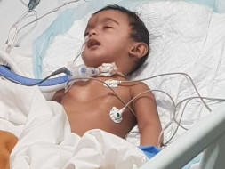 9 Months Old Baby Of Shruthi Needs Your Help Fight Pierre Robin Sequence