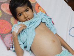 Her Bones Are Visible Through Her Skin, Cancer Is Spreading Rapidly