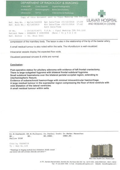 MRI-BRAIN-2