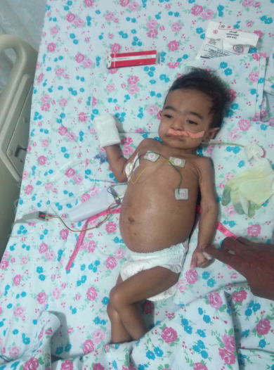 Out of Ventilator and shifted to ward