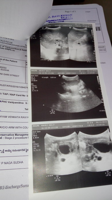 Scan reports